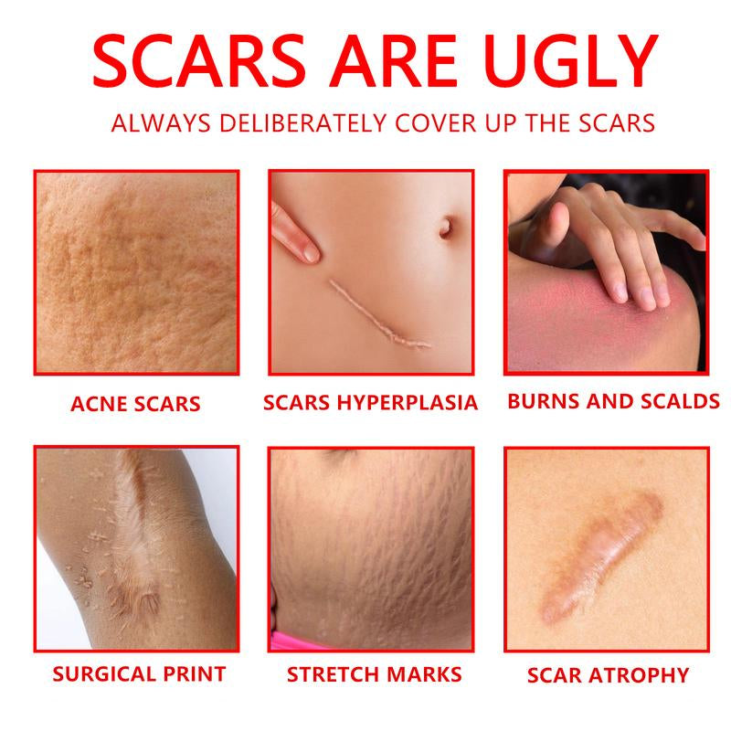 Professional Scar Removal Gel - Suitable for Acne Scars, Black Spots, Surgery, Cesarean Section, Burns, Acne and Other Scar Removal Treatment