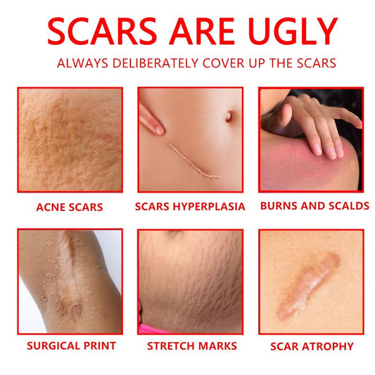 Professional Scar Removal Gel - Suitable for Acne Scars, Black Spots, Surgery, Cesarean Section, Burns, Acne and Other Scar Removal Treatment